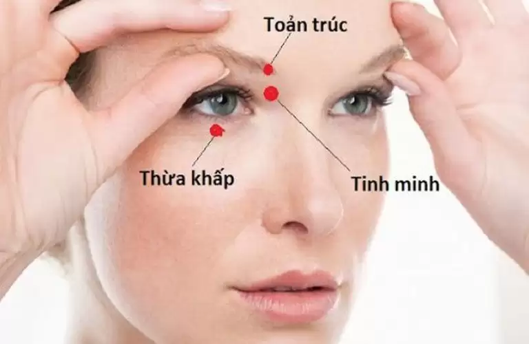 bấm huyệt chữa cận thị