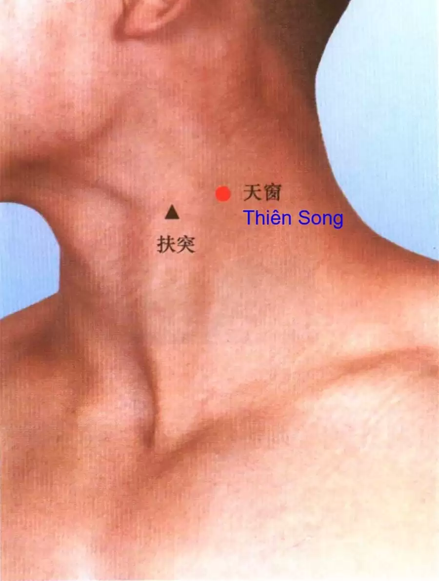 Vị trí và tác dụng của huyệt Thiên Song